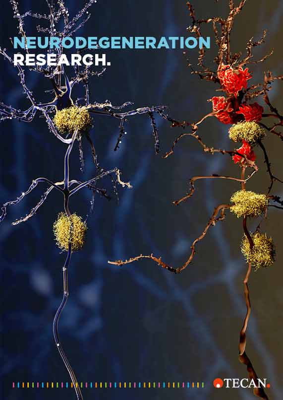 Brochure Neurodegeneration research