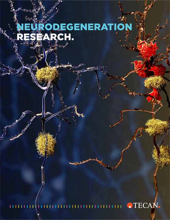 Brochure Neurodegeneration research