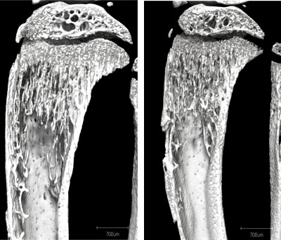alpha-Klotho deficiency leads to bone mass density loss